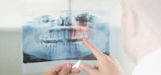 El Técnico Profesional en Radiología Dental
